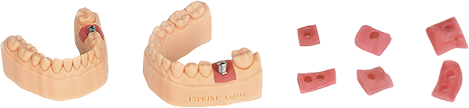 Области применения Dental Gingiva Resin Aidite