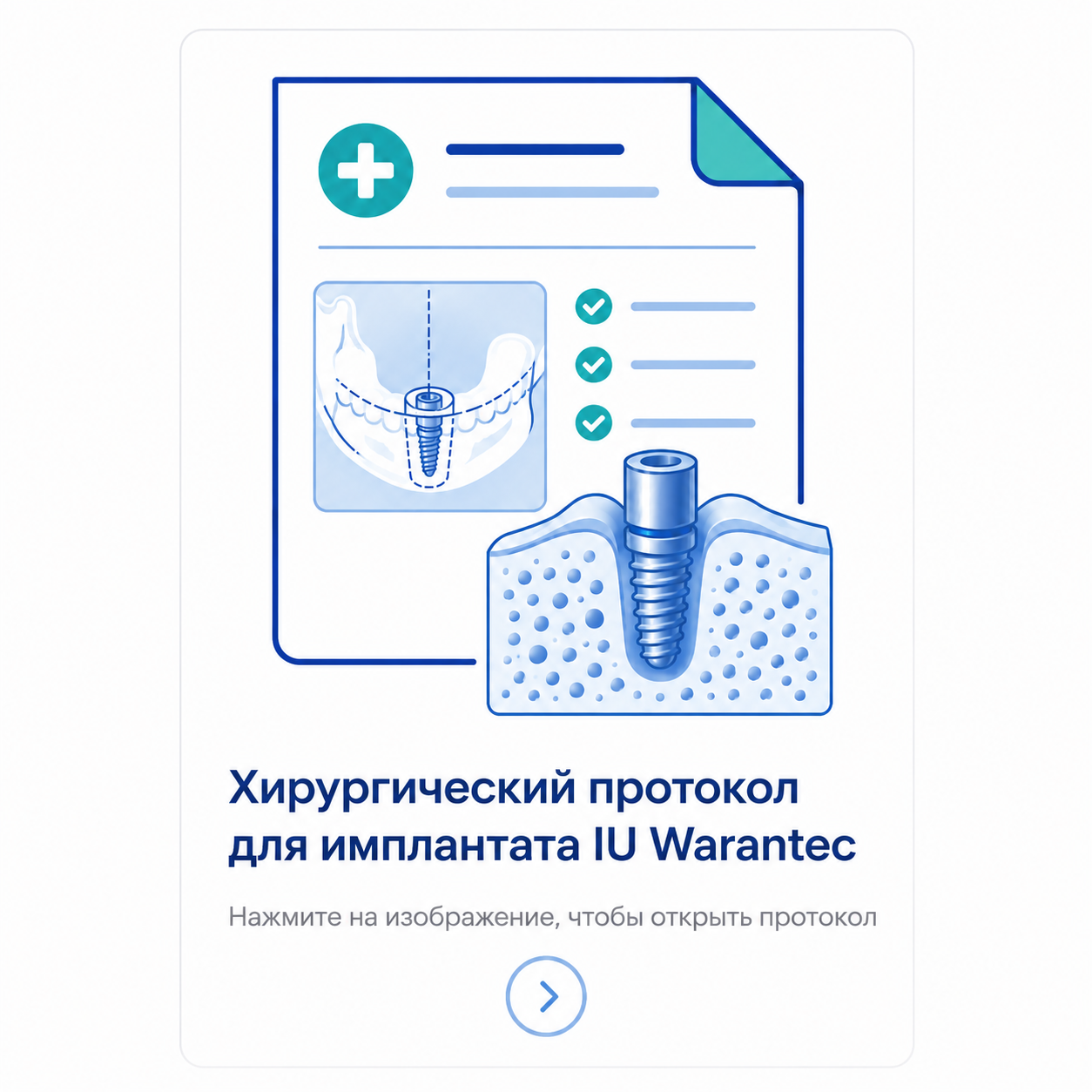 Хирургический протокол для имплантата IU Warantec