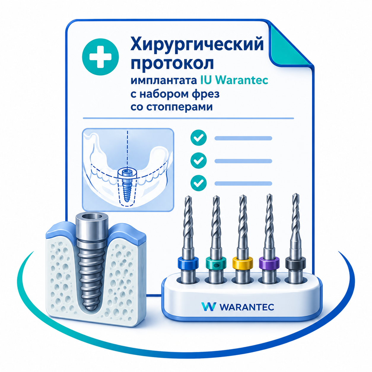 Хирургический протокол для имплантата IU Warantec с набором фрез со стопперами